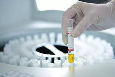 中國(guó)IVD試劑臨床使用現(xiàn)狀與挑戰(zhàn) 基于診斷技術(shù)研發(fā)視角的分析